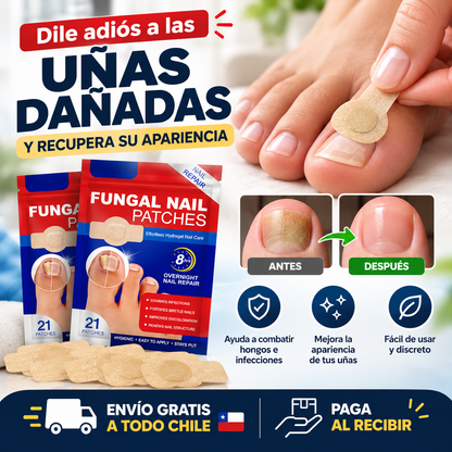 Parche Hongo De Uñas 2x1 - 42 Unidades